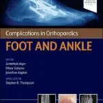خرید و دانلود نسخه کامل کتاب Complications in Orthopaedics: Foot and Ankle 1st edition + pdf