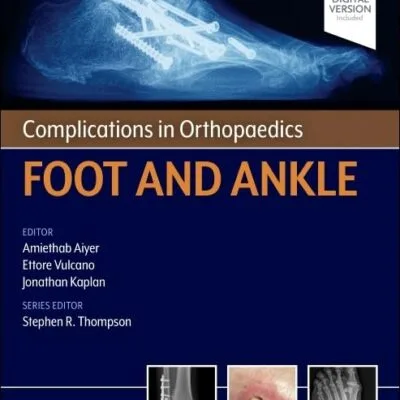 خرید و دانلود نسخه کامل کتاب Complications in Orthopaedics: Foot and Ankle 1st edition + pdf
