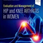 خرید و دانلود نسخه کامل کتاب Evaluation and Management of Hip and Knee Arthritis in Women 1st Edition