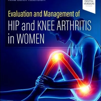خرید و دانلود نسخه کامل کتاب Evaluation and Management of Hip and Knee Arthritis in Women 1st Edition