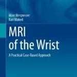 دانلود کتاب MRI of the Wrist: A Practical Case-Based Approach