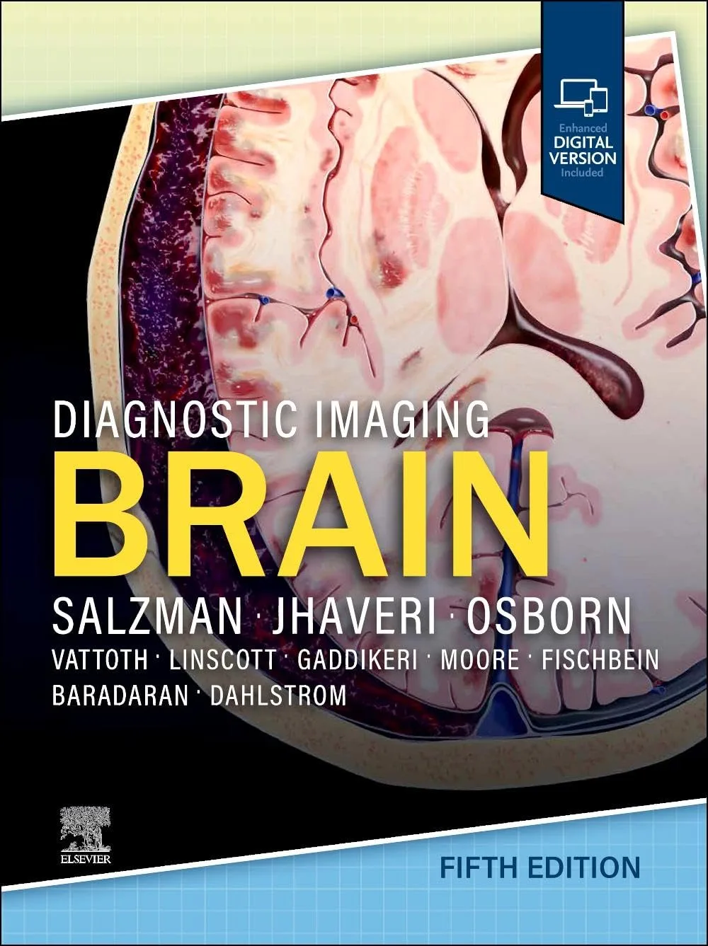 71uydcWZw9L._SL1337_ خرید و دانلود نسخه کامل کتاب Diagnostic Imaging: Brain 5th Edition - original pdf