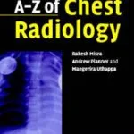 خرید و دانلود نسخه کامل کتاب A-Z of Chest Radiology