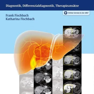 خرید و دانلود کتاب MRT der Leber: Diagnostik, Differenzialdiagnostik, Therapieansätze