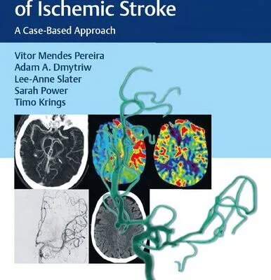 خرید و دانلود نسخه کامل کتاب Endovascular Management of Ischemic Stroke: A Case-based Approach