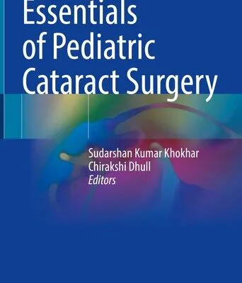 خرید و دانلود نسخه کامل کتاب Essentials of Pediatric Cataract Surgery