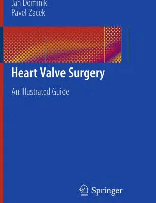 خرید و دانلود نسخه کامل کتاب Heart Valve Surgery: An Illustrated Guide