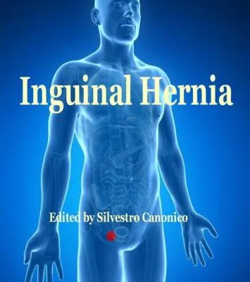 خرید و دانلود نسخه کامل کتاب Inguinal hernia