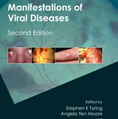 خرید و دانلود نسخه کامل کتاب Mucocutaneous Manifestations of Viral Diseases