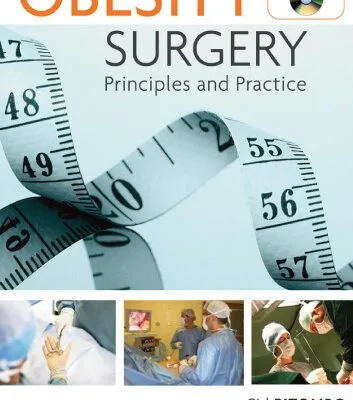 خرید و دانلود نسخه کامل کتاب Obesity Surgery: Principles and Practice
