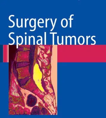 خرید و دانلود نسخه کامل کتاب Surgery of Spinal Tumors